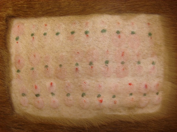 Intradermal Skin Test